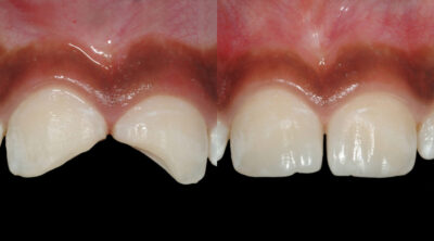Advanced Cosmetic Dentistry
