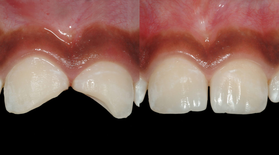 Advanced Cosmetic Dentistry