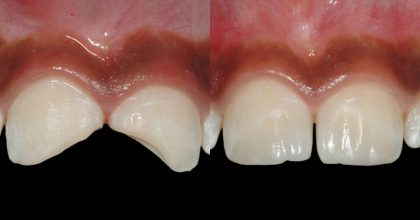 Advanced Cosmetic Dentistry