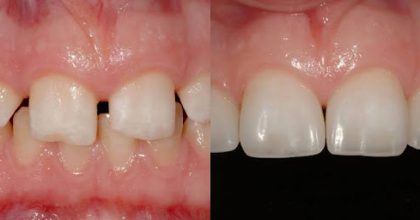 How Dental CE Can Help You Raise Your Treatment Fees Ethically and Confidently